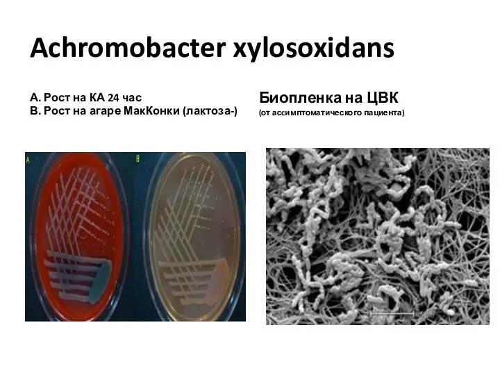 Achromobacter xylosoxidans А. Рост на КА 24 час В. Рост на