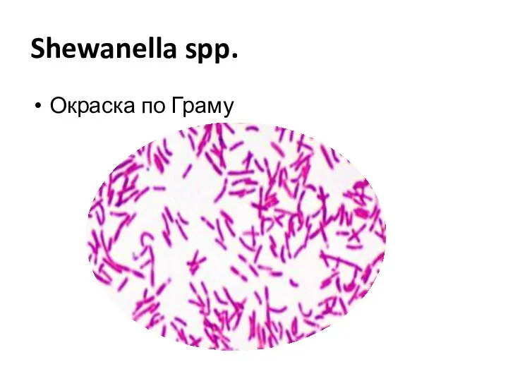 Shewanella spp. Окраска по Граму