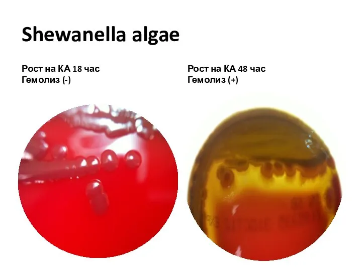 Shewanella algae Рост на КА 18 час Гемолиз (-) Рост на КА 48 час Гемолиз (+)