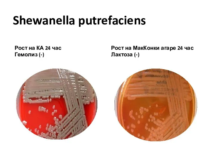 Shewanella putrefaciens Рост на КА 24 час Гемолиз (-) Рост на