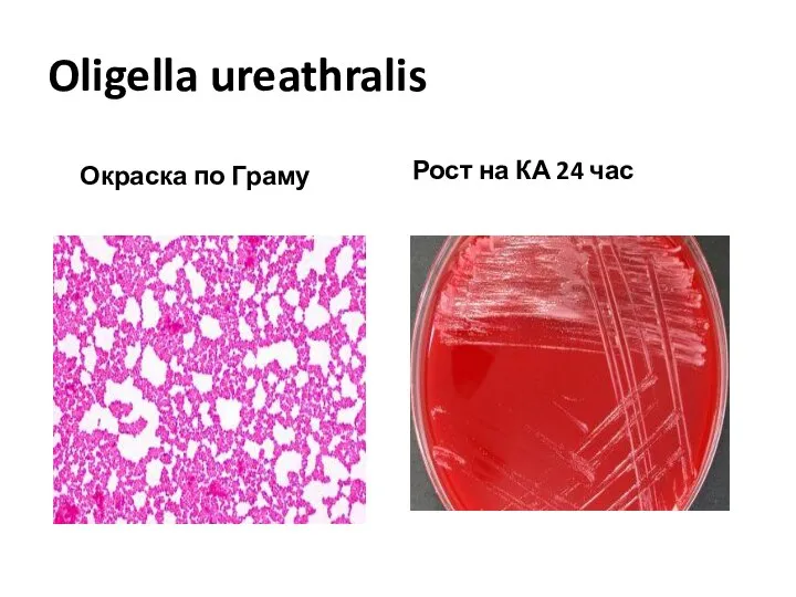 Oligella ureathralis Окраска по Граму Рост на КА 24 час