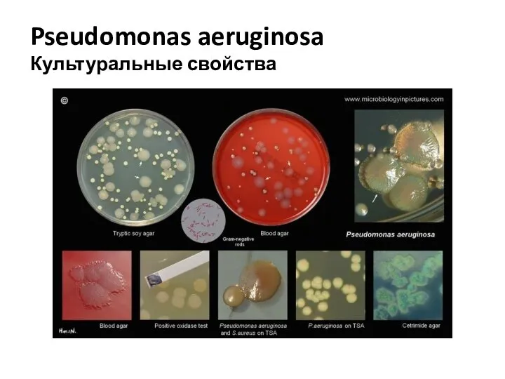 Pseudomonas aeruginosa Культуральные свойства