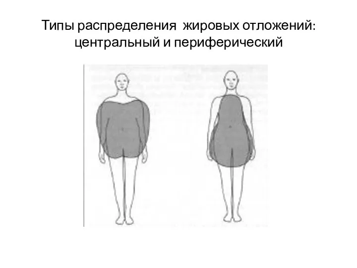 Типы распределения жировых отложений: центральный и периферический