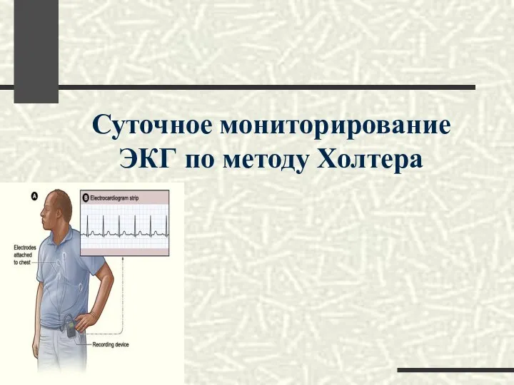 Суточное мониторирование ЭКГ по методу Холтера