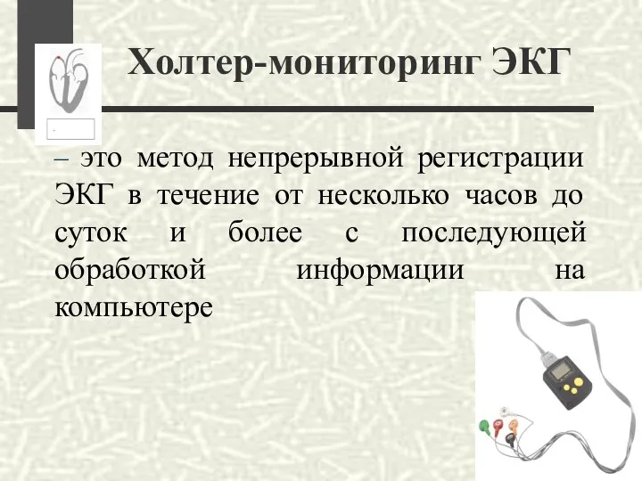 Холтер-мониторинг ЭКГ – это метод непрерывной регистрации ЭКГ в течение от