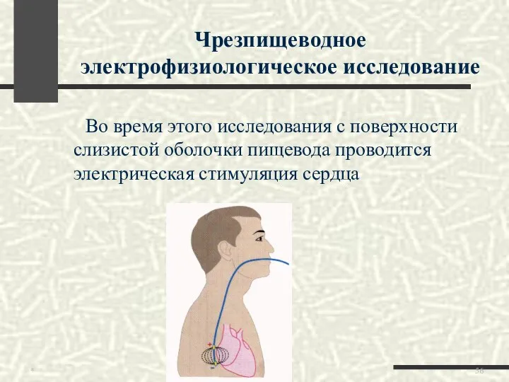 Во время этого исследования с поверхности слизистой оболочки пищевода проводится электрическая