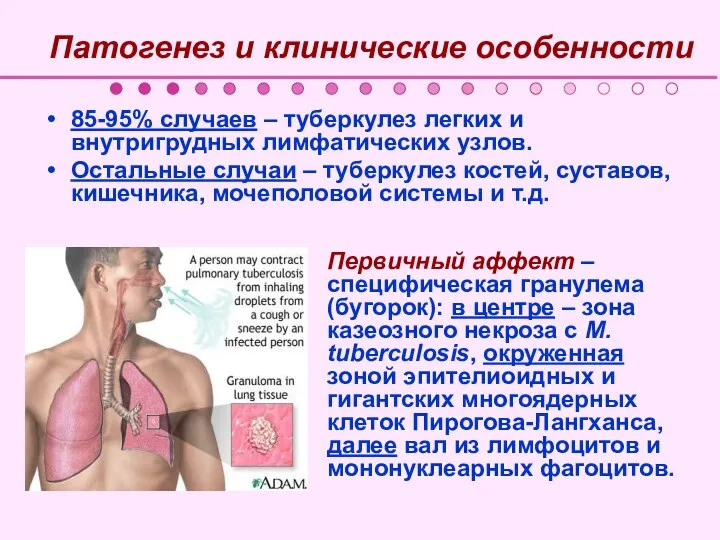 Патогенез и клинические особенности 85-95% случаев – туберкулез легких и внутригрудных