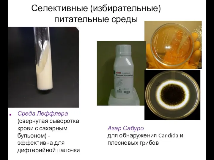 Селективные (избирательные) питательные среды Среда Леффлера (свернутая сыворотка крови с сахарным