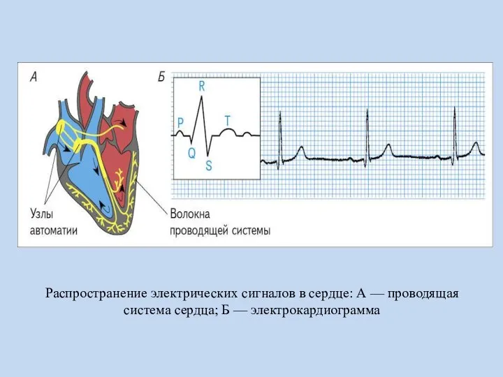 Распространение электрических сигналов в сердце: А — проводящая система сердца; Б — электрокардиограмма