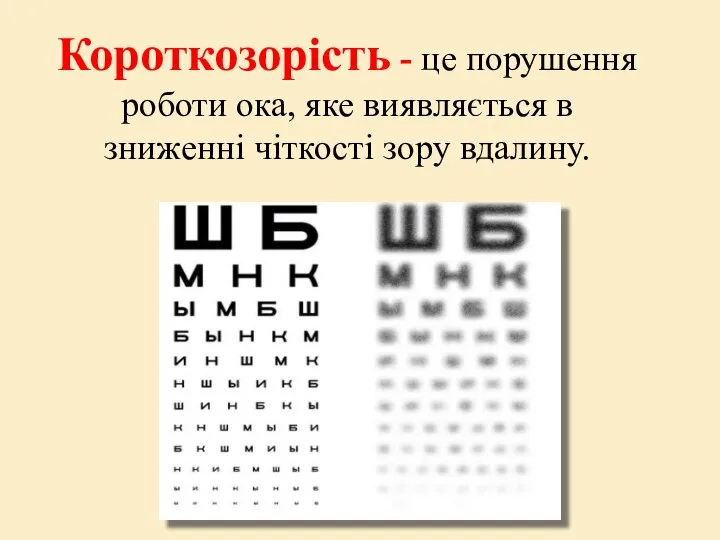 Короткозорість - це порушення роботи ока, яке виявляється в зниженні чіткості зору вдалину.