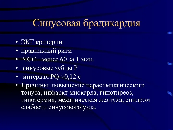 Синусовая брадикардия ЭКГ критерии: правильный ритм ЧСС - менее 60 за