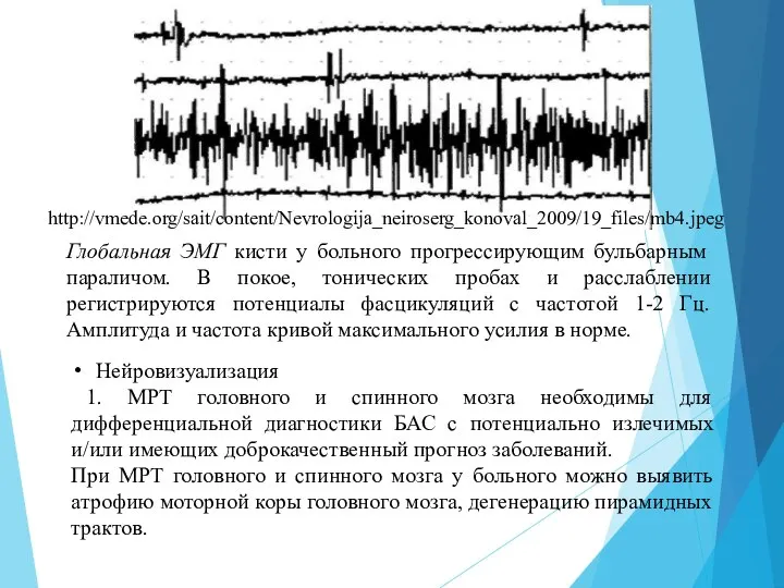 Нейровизуализация ​ 1. MPT головного и спинного мозга необходимы для дифференциальной