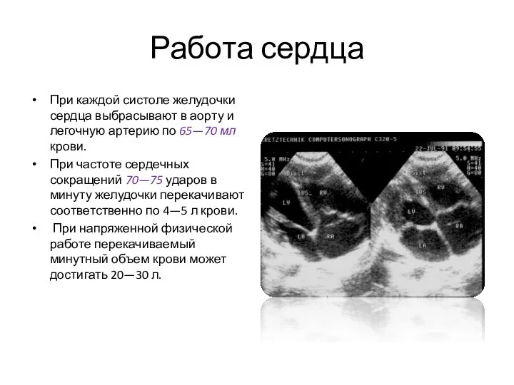 Работа сердца При каждой систоле желудочки сердца выбрасывают в аорту и