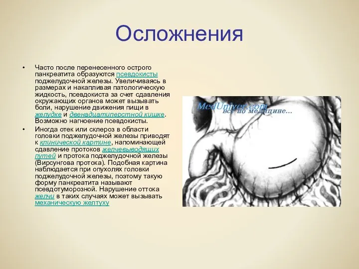 Осложнения Часто после перенесенного острого панкреатита образуются псевдокисты поджелудочной железы. Увеличиваясь