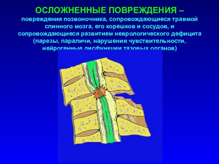 ОСЛОЖНЕННЫЕ ПОВРЕЖДЕНИЯ – повреждения позвоночника, сопровождающиеся травмой спинного мозга, его корешков