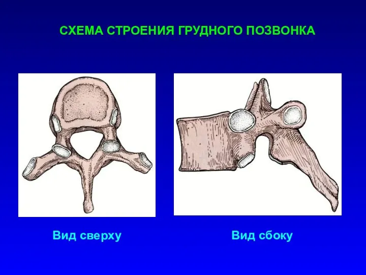 СХЕМА СТРОЕНИЯ ГРУДНОГО ПОЗВОНКА Вид сверху Вид сбоку