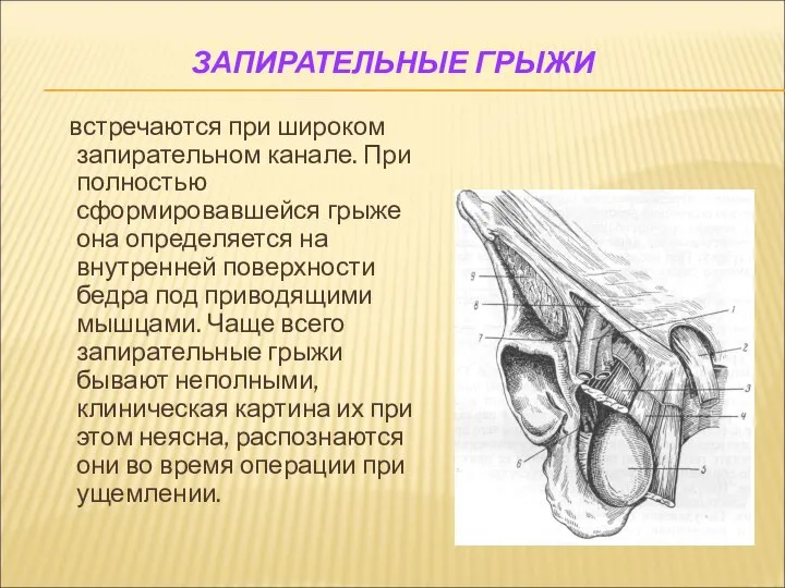 ЗАПИРАТЕЛЬНЫЕ ГРЫЖИ встречаются при широком запирательном канале. При полностью сформировавшейся грыже