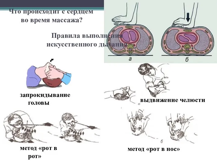 Что происходит с сердцем во время массажа? Правила выполнения искусственного дыхания