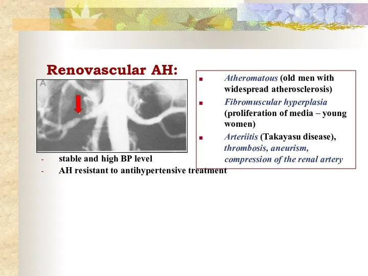 Renovascular AH: stable and high BP level AH resistant to antihypertensive