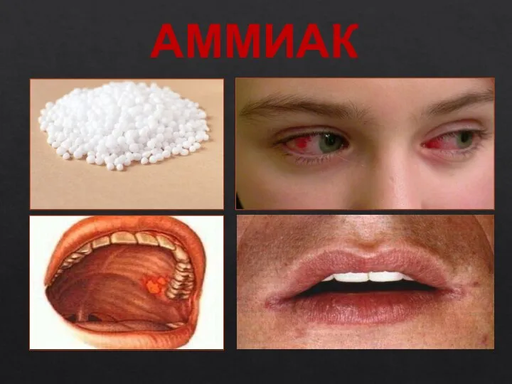 АММИАК