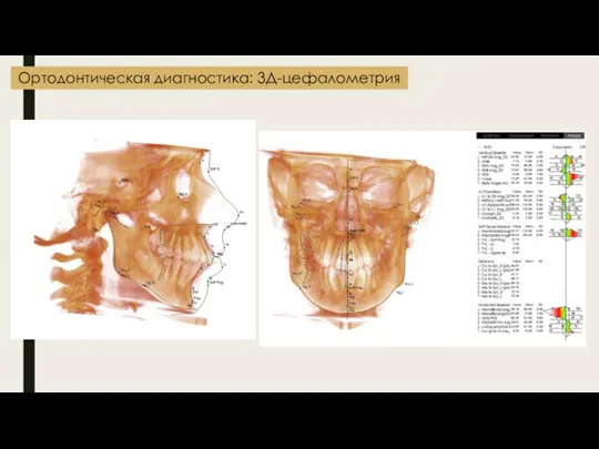 Ортодонтическая диагностика: 3Д-цефалометрия