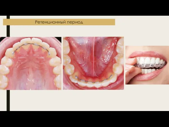 Ретенционный период