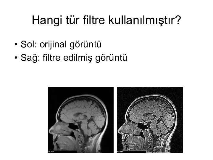 Hangi tür filtre kullanılmıştır? Sol: orijinal görüntü Sağ: filtre edilmiş görüntü