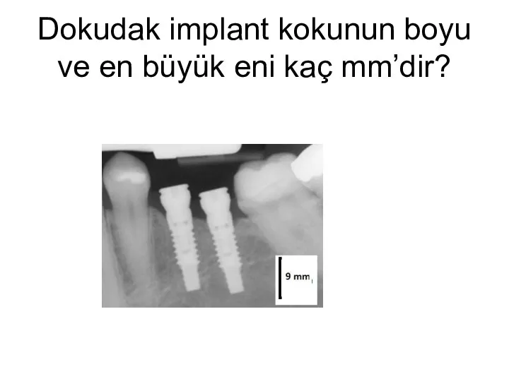 Dokudak implant kokunun boyu ve en büyük eni kaç mm’dir?