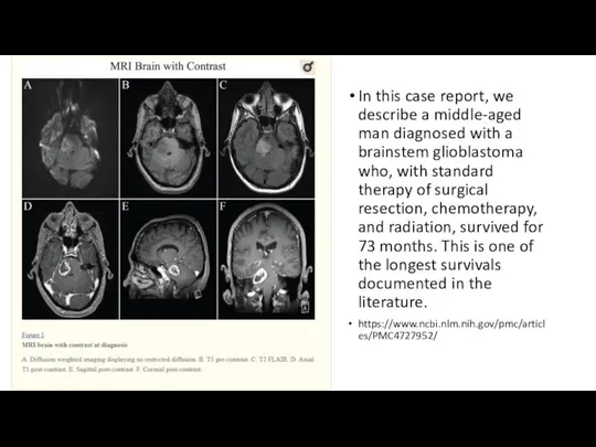 In this case report, we describe a middle-aged man diagnosed with