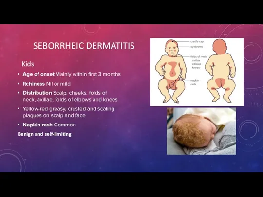 Kids Age of onset Mainly within first 3 months Itchiness Nil