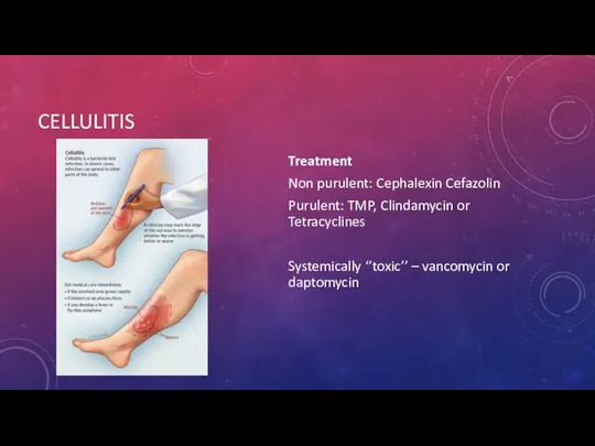 CELLULITIS Treatment Non purulent: Cephalexin Cefazolin Purulent: TMP, Clindamycin or Tetracyclines