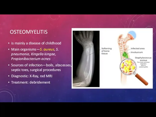 OSTEOMYELITIS is mainly a disease of childhood Main organisms—S. aureus, S.