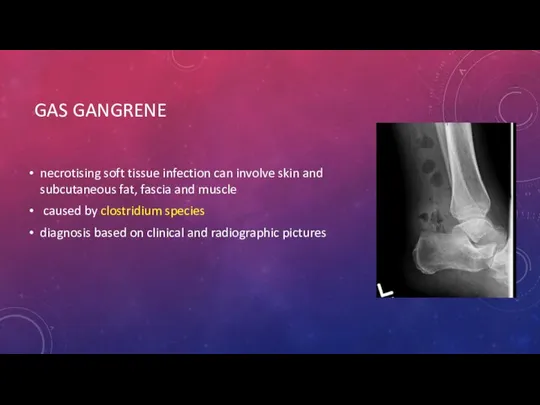 GAS GANGRENE necrotising soft tissue infection can involve skin and subcutaneous