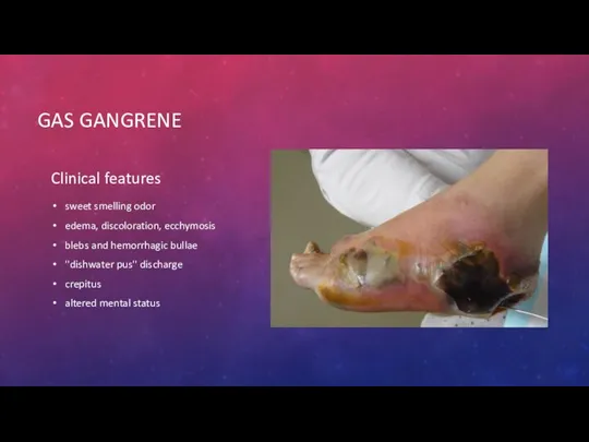 GAS GANGRENE Clinical features sweet smelling odor edema, discoloration, ecchymosis blebs