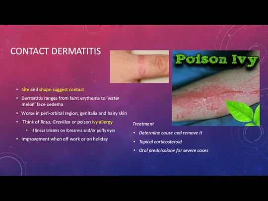 CONTACT DERMATITIS Site and shape suggest contact Dermatitis ranges from faint