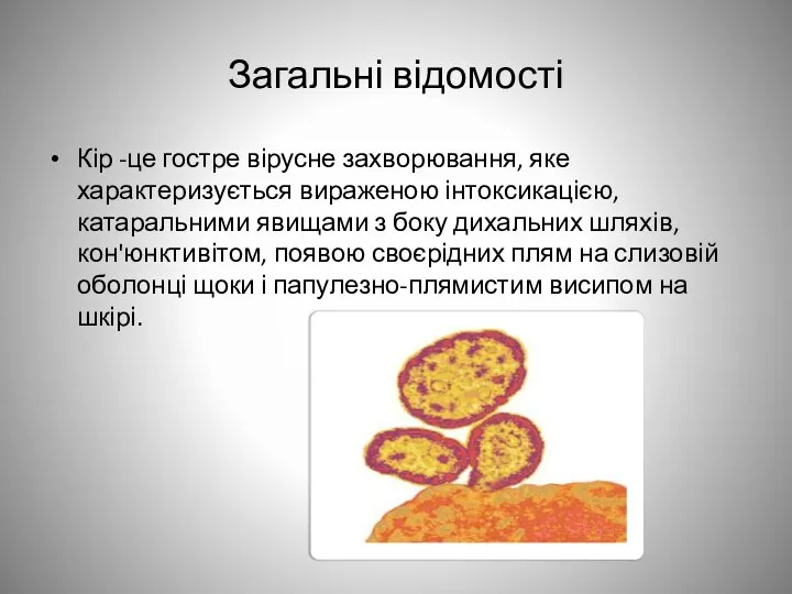 Загальні відомості Кір -це гостре вірусне захворювання, яке характеризується вираженою інтоксикацією,