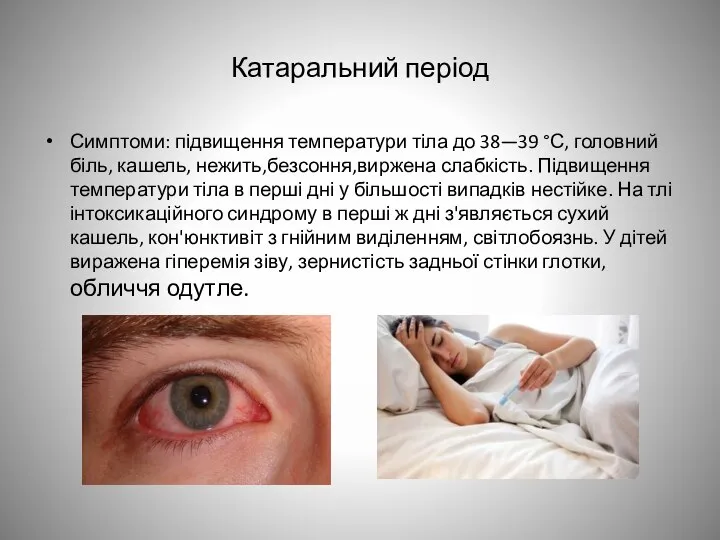 Катаральний період Симптоми: підвищення температури тіла до 38—39 °С, головний біль,