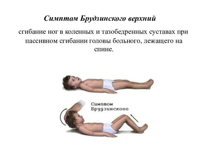 Симптом Брудзинского верхний сгибание ног в коленных и тазобедренных суставах при