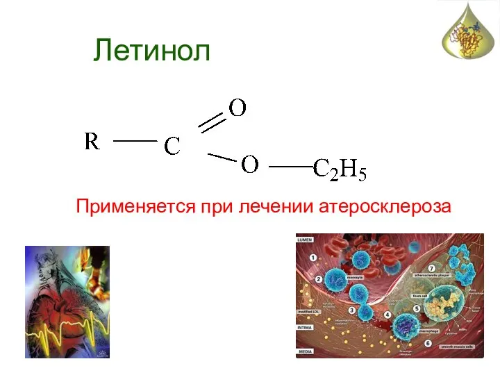 Летинол Применяется при лечении атеросклероза