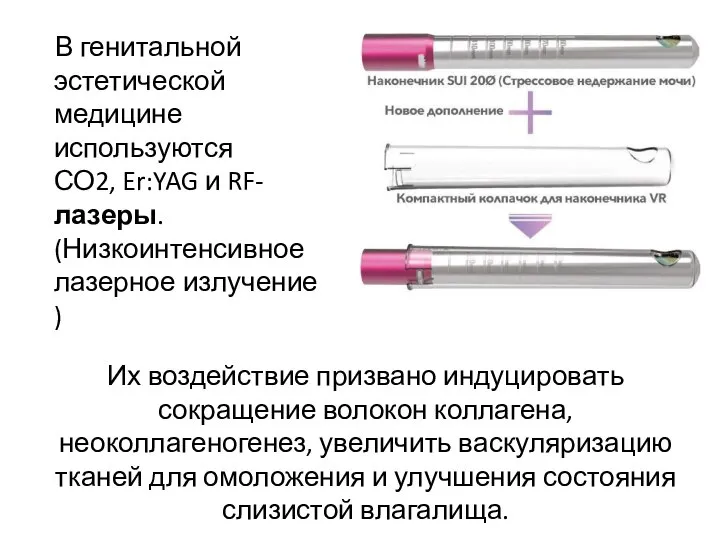 В генитальной эстетической медицине используются СО2, Er:YAG и RF-лазеры. (Низкоинтенсивное лазерное