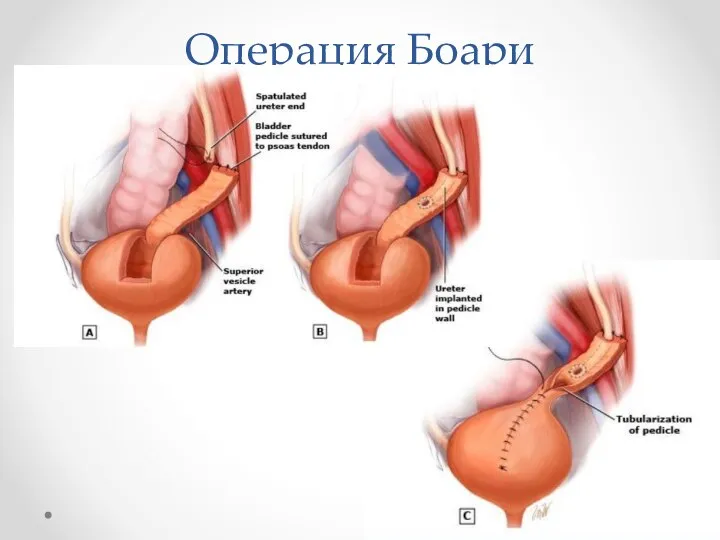 Операция Боари