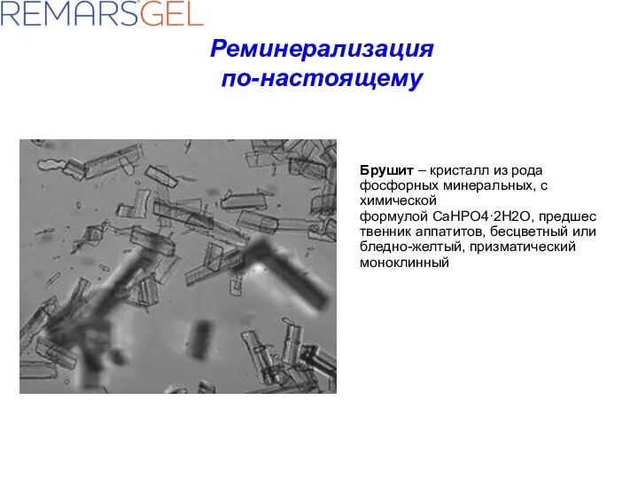 Брушит – кристалл из рода фосфорных минеральных, с химической формулой CaHPO4·2H2O,