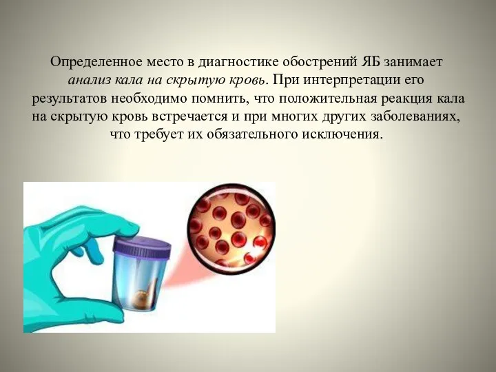 Определенное место в диагностике обострений ЯБ занимает анализ кала на скрытую