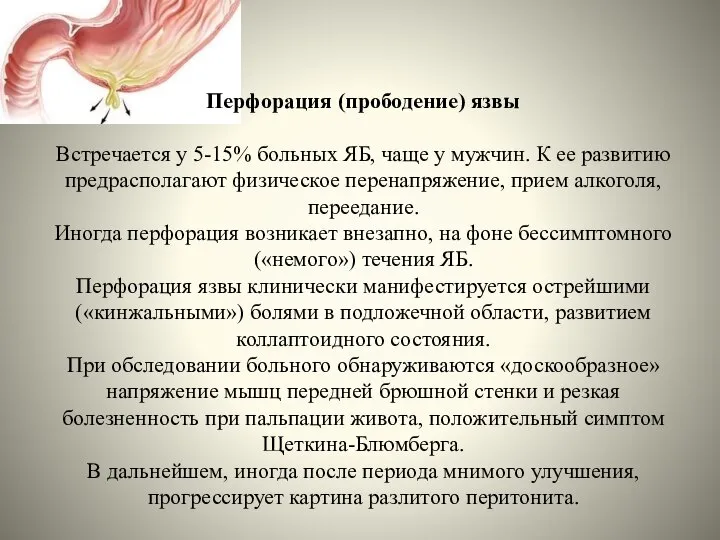 Перфорация (прободение) язвы Встречается у 5-15% больных ЯБ, чаще у мужчин.