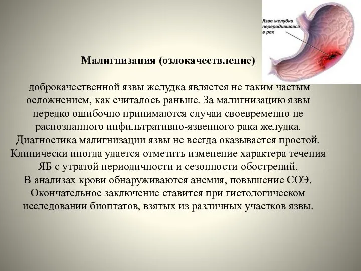 Малигнизация (озлокачествление) доброкачественной язвы желудка является не таким частым осложнением, как