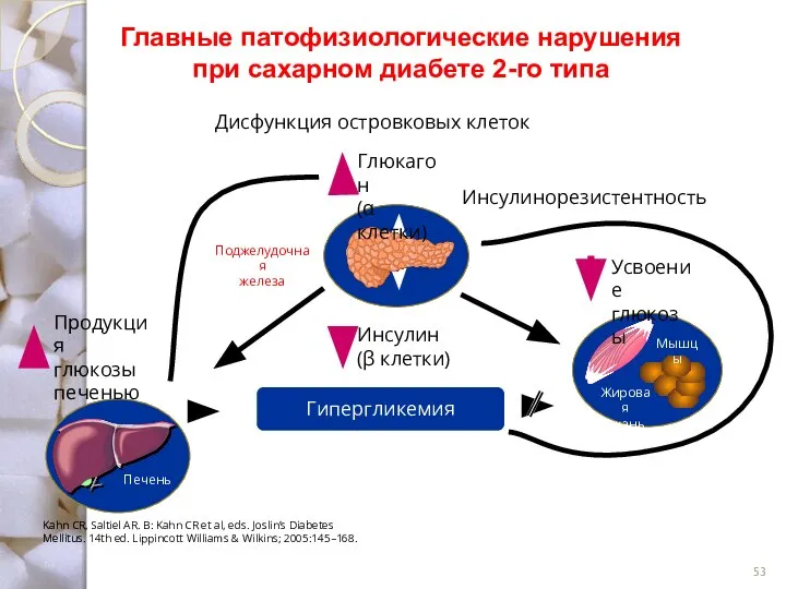 Главные патофизиологические нарушения при сахарном диабете 2-го типа Дисфункция островковых клеток