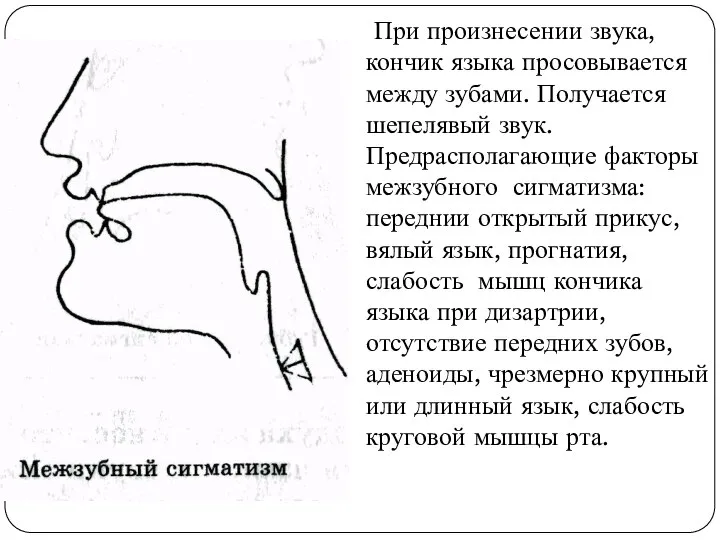 При произнесении звука, кончик языка просовывается между зубами. Получается шепелявый звук.