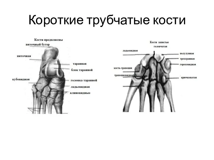 Короткие трубчатые кости