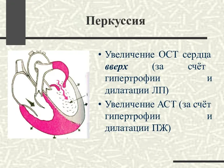 Перкуссия Увеличение ОСТ сердца вверх (за счёт гипертрофии и дилатации ЛП)