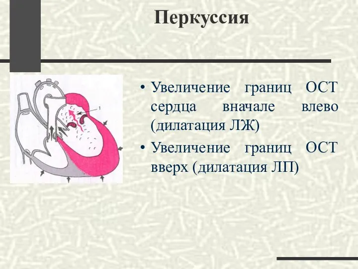 Перкуссия Увеличение границ ОСТ сердца вначале влево (дилатация ЛЖ) Увеличение границ ОСТ вверх (дилатация ЛП)